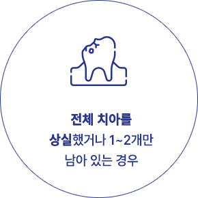 전체 임플란트 추천 대상