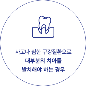 전체 임플란트 추천 대상