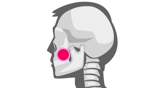 고난도 임플란트