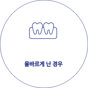 사랑니 발치 형태