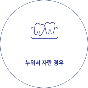 사랑니 발치 형태